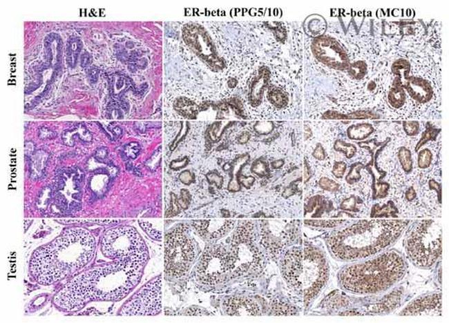 Estrogen Receptor beta Antibody in Immunohistochemistry (IHC)