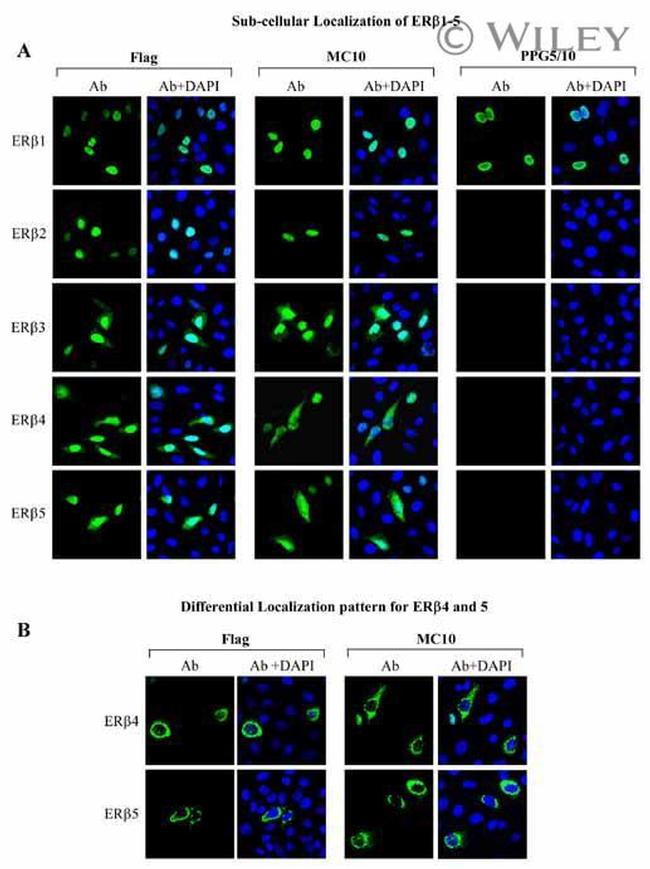 Estrogen Receptor beta Antibody in Immunocytochemistry (ICC/IF)