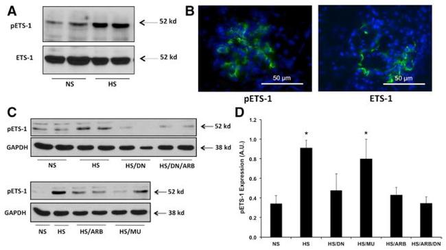 Phospho-ETS1 (Thr38) Antibody in Western Blot, Immunohistochemistry (WB, IHC)