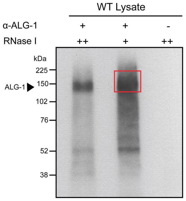 ALG1 Antibody in Immunoprecipitation (IP)