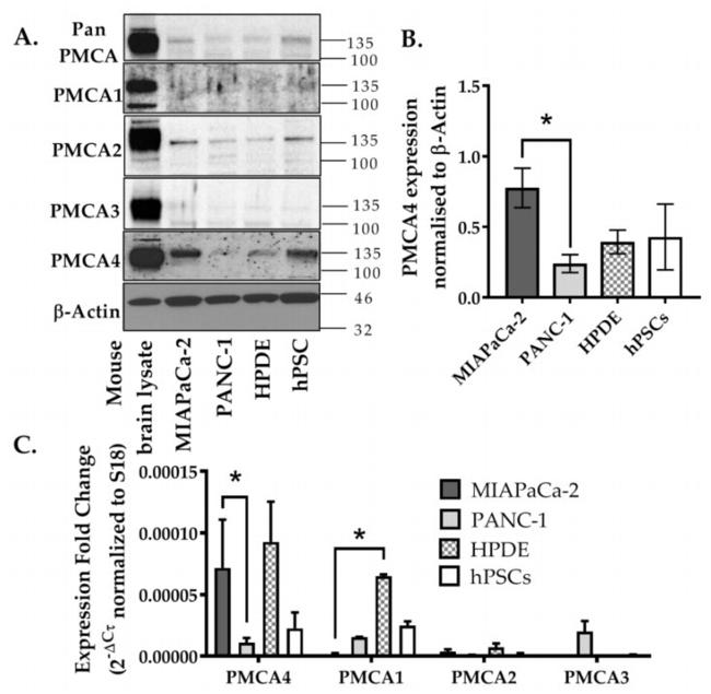 PMCA4 ATPase Antibody in Western Blot (WB)