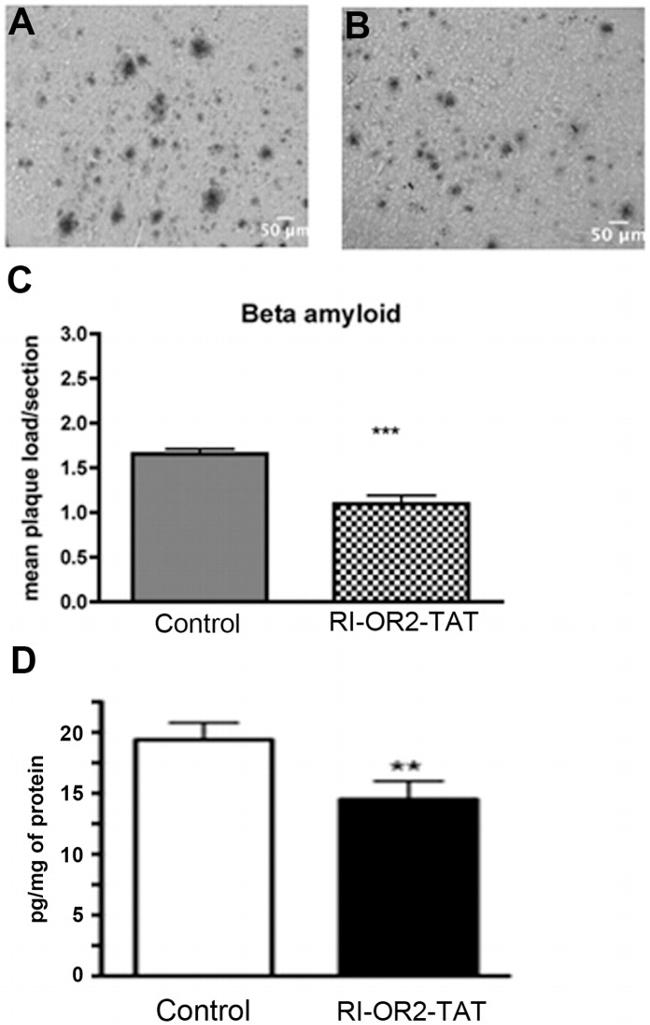 beta Amyloid Antibody in Immunohistochemistry (Frozen) (IHC (F))