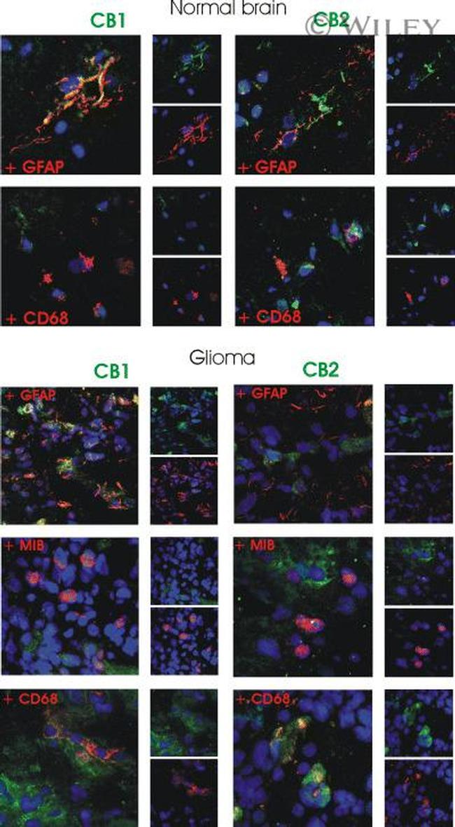 CNR2 Antibody in Immunohistochemistry (IHC)