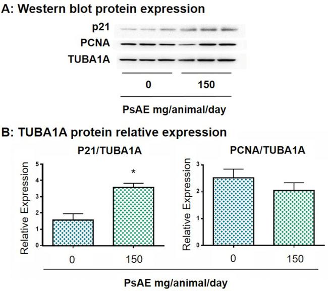 PARP1 (cleaved Asp214, Asp215) Antibody in Western Blot (WB)