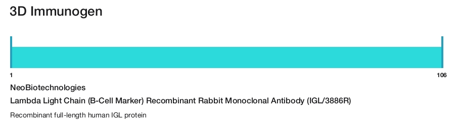 Lambda Light Chain (B-Cell Marker) Recombinant Rabbit Monoclonal Antibody (IGL/3886R)