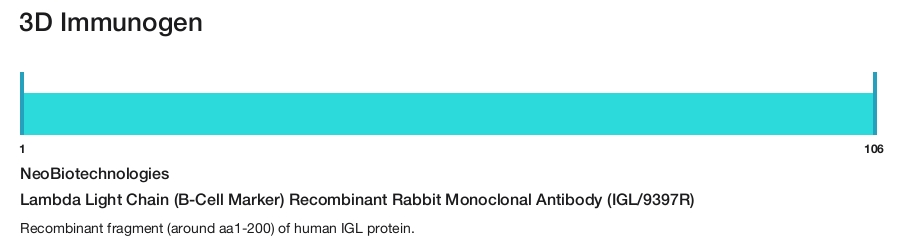 Lambda Light Chain (B-Cell Marker) Recombinant Rabbit Monoclonal Antibody (IGL/9397R)