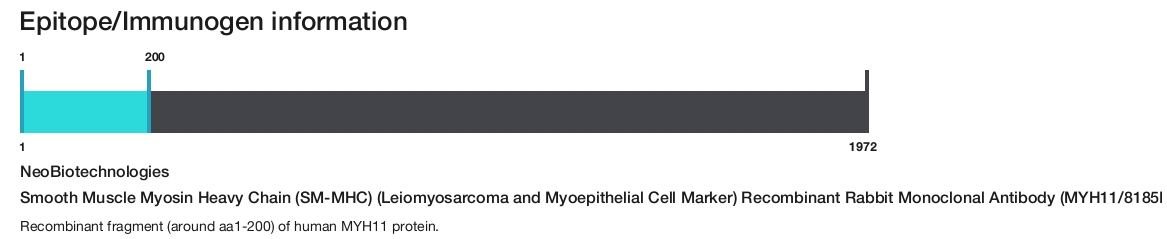 Smooth Muscle Myosin Heavy Chain (SM-MHC) (Leiomyosarcoma and Myoepithelial Cell Marker) Recombinant Rabbit Monoclonal Antibody (MYH11/8185R)