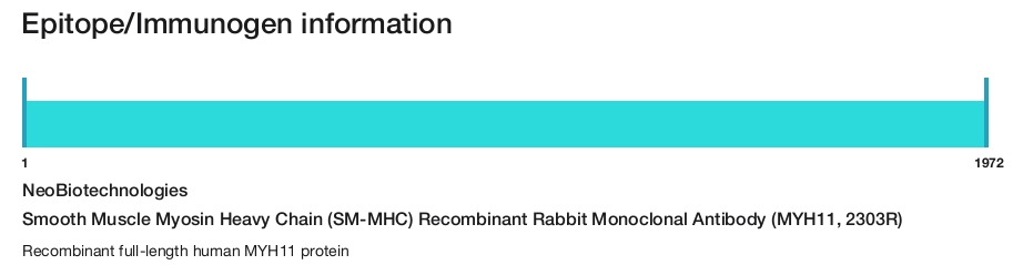 Smooth Muscle Myosin Heavy Chain (SM-MHC) Recombinant Rabbit Monoclonal Antibody (MYH11, 2303R)