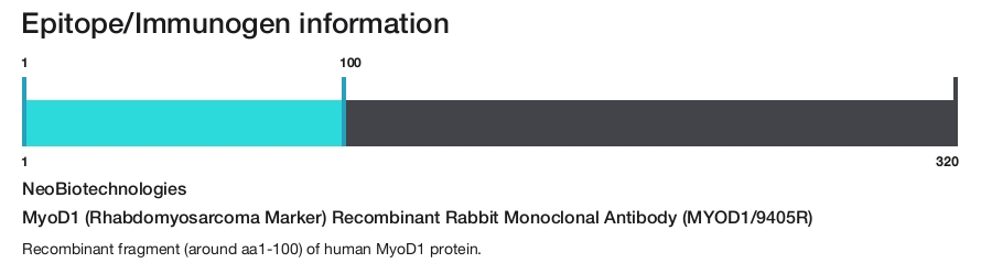 MyoD1 (Rhabdomyosarcoma Marker) Recombinant Rabbit Monoclonal Antibody (MYOD1/9405R)