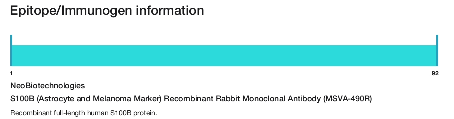 S100B (Astrocyte and Melanoma Marker) Recombinant Rabbit Monoclonal Antibody (MSVA-490R)