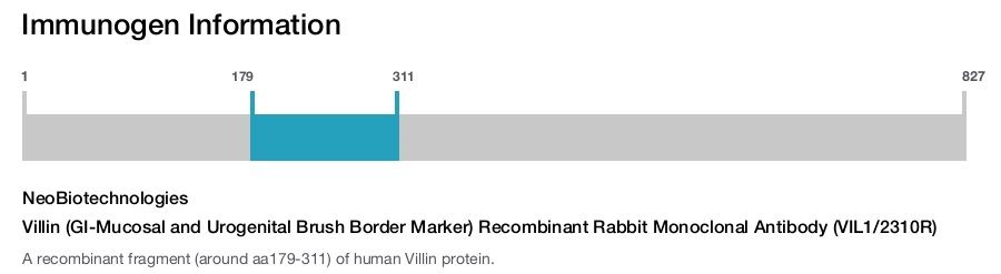 Villin (GI-Mucosal and Urogenital Brush Border Marker) Recombinant Rabbit Monoclonal Antibody (VIL1/2310R)