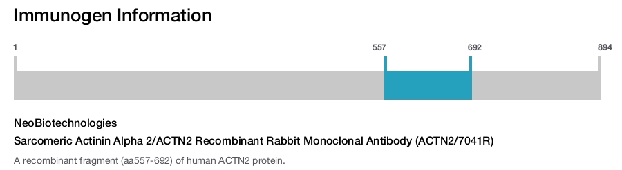 Sarcomeric Actinin Alpha 2/ACTN2 Recombinant Rabbit Monoclonal Antibody (ACTN2/7041R)