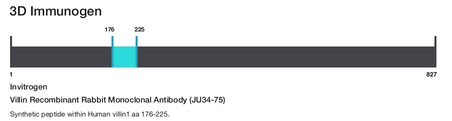 Villin Recombinant Rabbit Monoclonal Antibody (JU34-75)