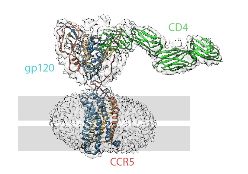 electron microscopy hiv