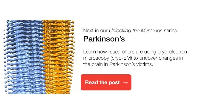 parkinsons