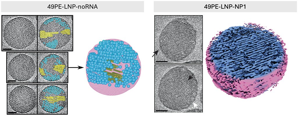 Lipid nanoparticles visualized with cryo electron tomography.