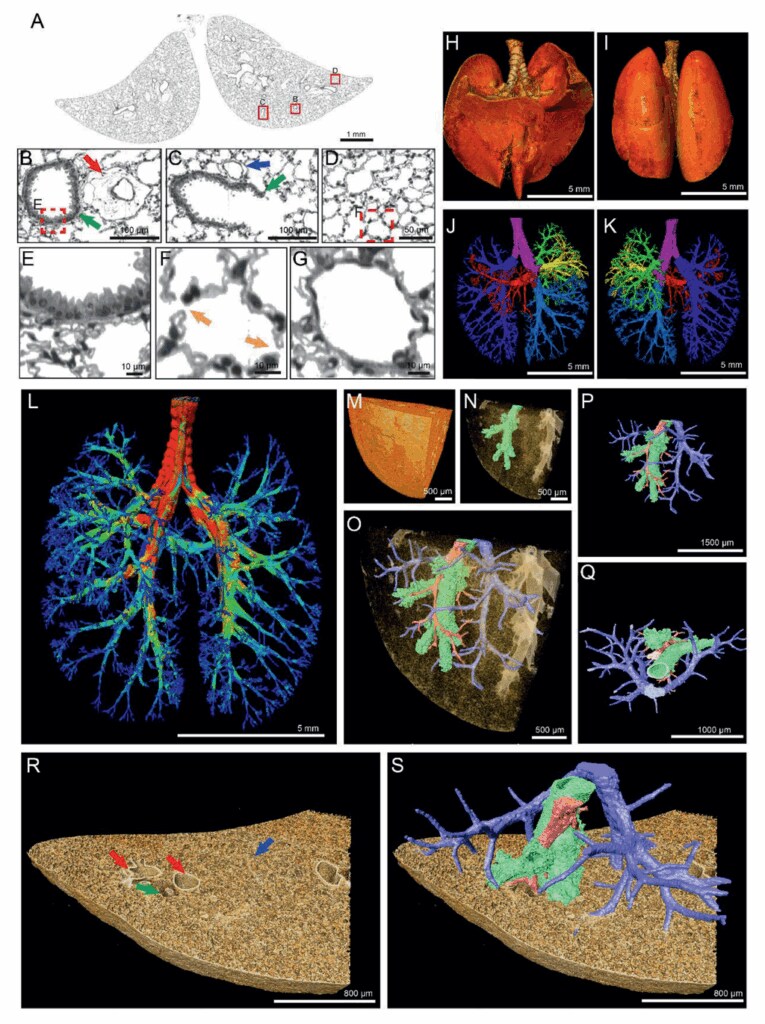 3D rendering of trachea and lung vasculature determined with tomography.