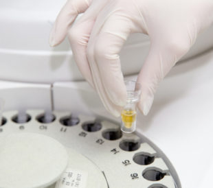 Urine samples in cetrifuge. Image: PhotoSkech/Shutterstock.com
