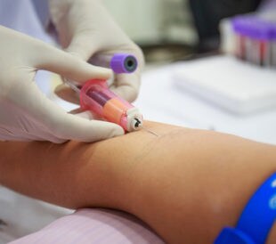 Nurse collecting blood samples. Image: WathanyuSowong/Shutterstock.com