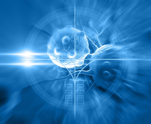 Cancer call. Image:  jovan vitanovski/Shutterstock.com