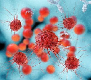 Cancer cells. Image: xrender/Shutterstock.com