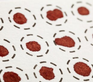Dried blood spots on a fiber filter. Image: marekuliasz/Shutterstock.com