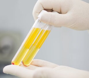 Plasma samples in test tube. Image: Fly_dragonfly/Shutterstock.com