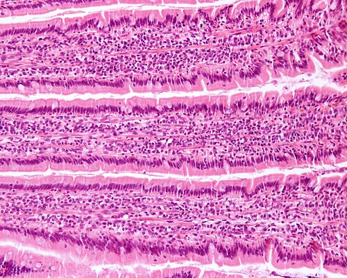 Cross-section of ileum. Image: Jose Luis Calvo/Shutterstock.com