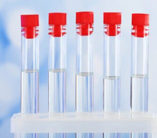 Test tubes with cerebrospinal fluid. Image: Africa Studio/Shutterstock.com