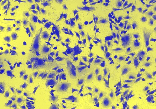Cervical cancer HeLa cells under a miscroscope. Image: Heiti Paves/Shutterstock.com