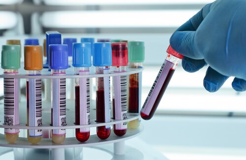 Test tubes of blood being placed in a centrifuge. Image: angellodeco/Shutterstock.com