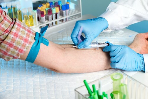 Laboratory with nurse taking a blood sample from patient, in background samples blood and urine tubes. Image: angellodeco/Shutterstock.com.