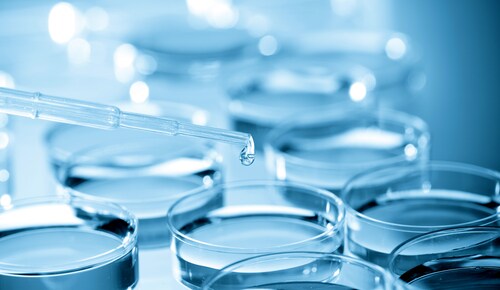 Pipette adding fluid to one of several test tubes. Image: science photo/Shutterstock.com.
