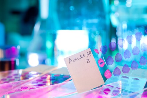 Slide glass with histological sections for microscopy. Image: anyaivanova/Shutterstock.com.