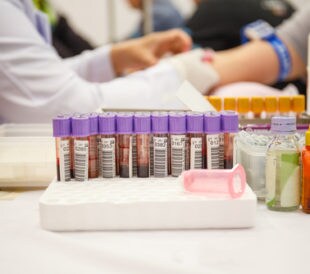 Laboratory with nurse taking a blood sample from patient, in background samples blood. Image: WathanyuSowong/Shutterstock.com.