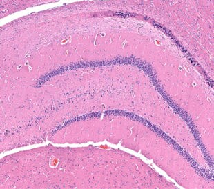 Necrosis of the hippocampal neurons in a rat brain with mineral deposits. Image: vetpathologist/Shutterstock.com.