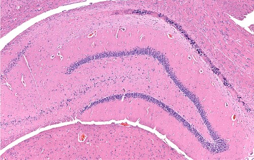 Necrosis of the hippocampal neurons in a rat brain with mineral deposits. Image: vetpathologist/Shutterstock.com.