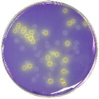 clostridium perfringens in food