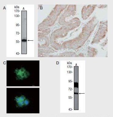 SHC1に対する抗体を使用した、（A）A431（不死化ヒト類表皮がん）細胞のウェスタンブロット解析、（B）パラフィン包埋した結腸がん切片の免疫組織化学分析、（C）A431細胞の免疫蛍光分析、および（D）NIH/3T3（不死化マウス胚線維芽細胞）細胞由来SHC1のウェスタンブロット検出