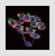 LPA Mouse Monoclonal Antibody (4H1)