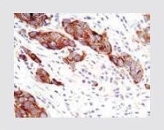 PI3 Kinase p110-alpha Rabbit Monoclonal Antibody (H.843.0)