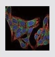 PIK3R1 Mouse Monoclonal Antibody (6G10)