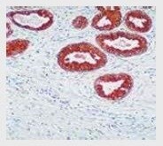 PTEN Rabbit Monoclonal Antibody (PN37)：抗PTEN抗体（製品番号 18-0256）を使用した、ヒト前立腺組織の免疫組織化学染色。