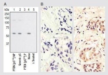 Phospho-PTEN pSer370 Rabbit Polyclonal Antibody