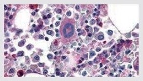 Thrombin Receptor/PAR1 Rabbit Polyclonal Antibody