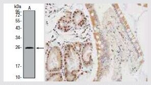 VHLウサギポリクローナル抗体
