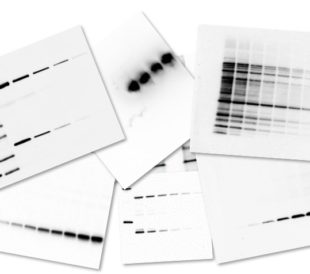 westernblotting