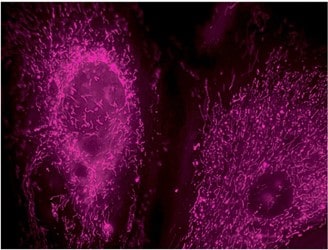 MitoTracker Deep Red FM Dyeで染色したウシ肺動脈内皮細胞