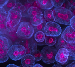 Colorectal tumoroid cells stained with fluorescent markers.