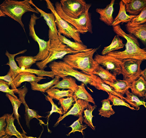 Cell painting image of U2OS cells obtained using the CellInsight CX7 LZR Pro instrument